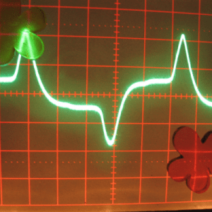 A minimal ecg screen displaying a heartbeat.